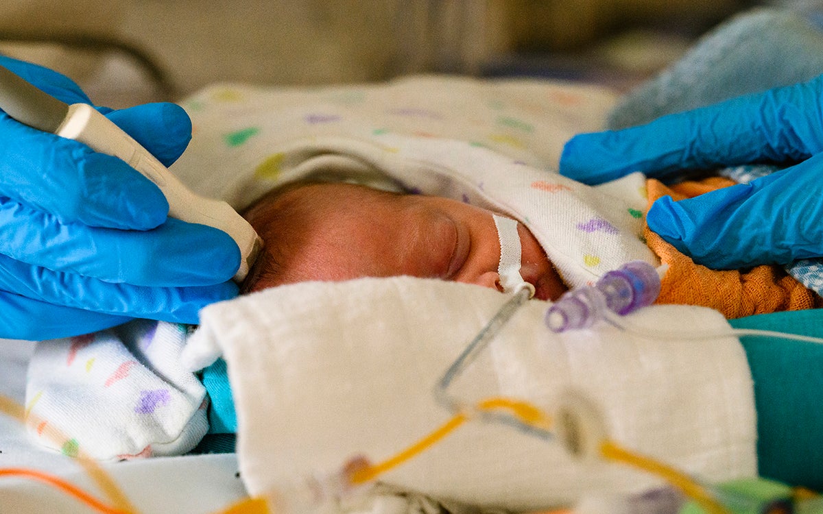 Een echo maken van de hersenen van een baby