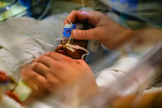 Te vroeg geboren baby krijgt extra zuurstof