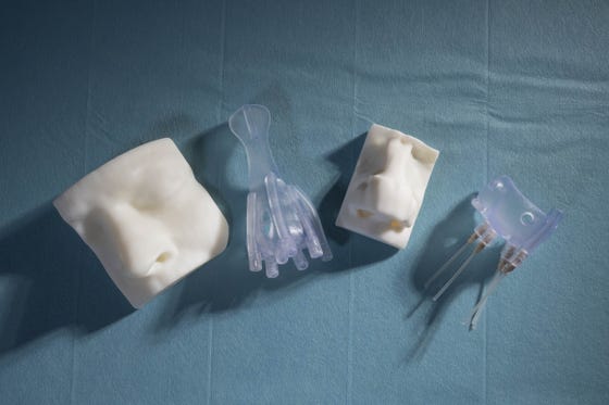 De innovatieve 3D-geprinte mal, die de behandeling van neuskanker nauwkeuriger en patiëntvriendelijker maakt.