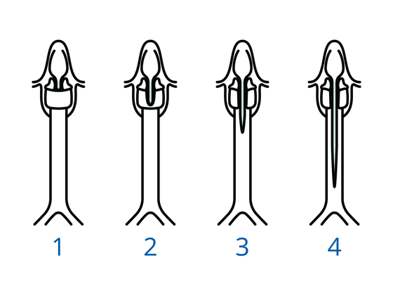 Vier schematische weergaven van een strottenhoofdspleet. 