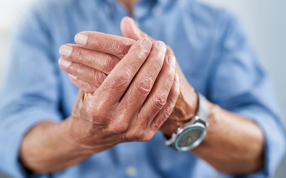 Mannenhand met reuma