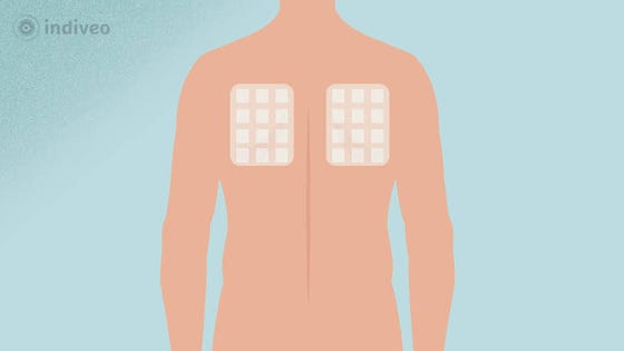 plakproef allergietest