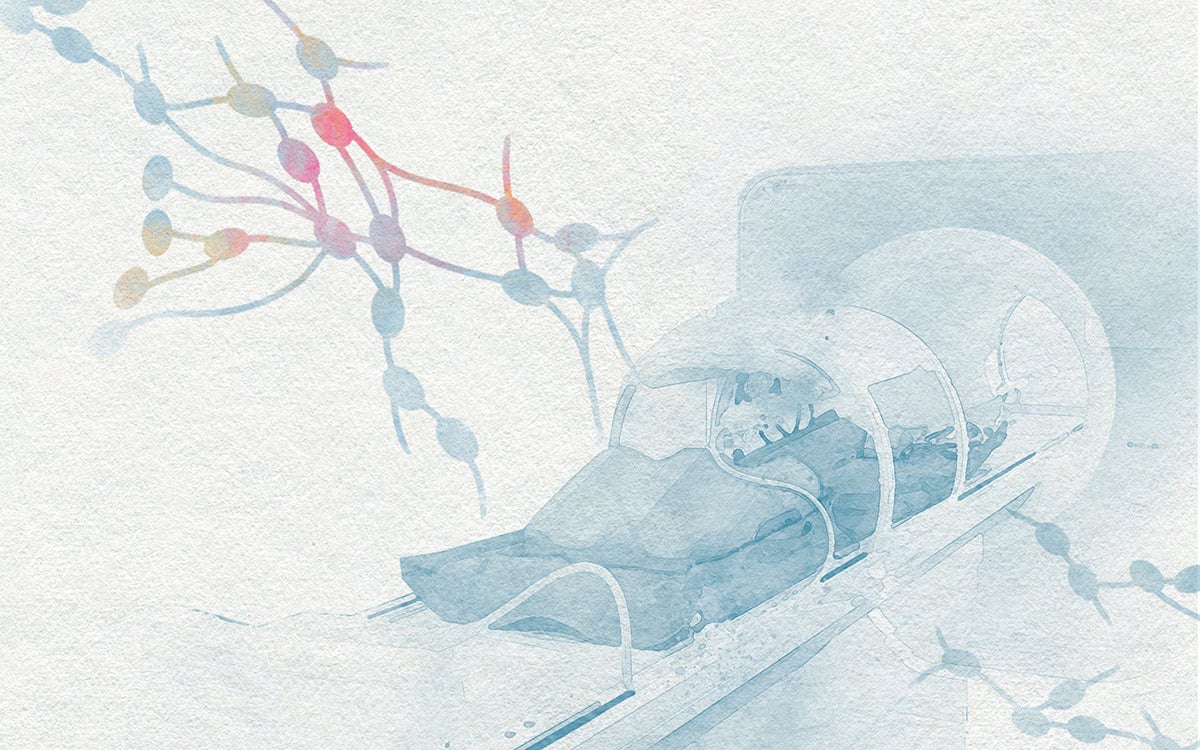 Aquarel MRI scan