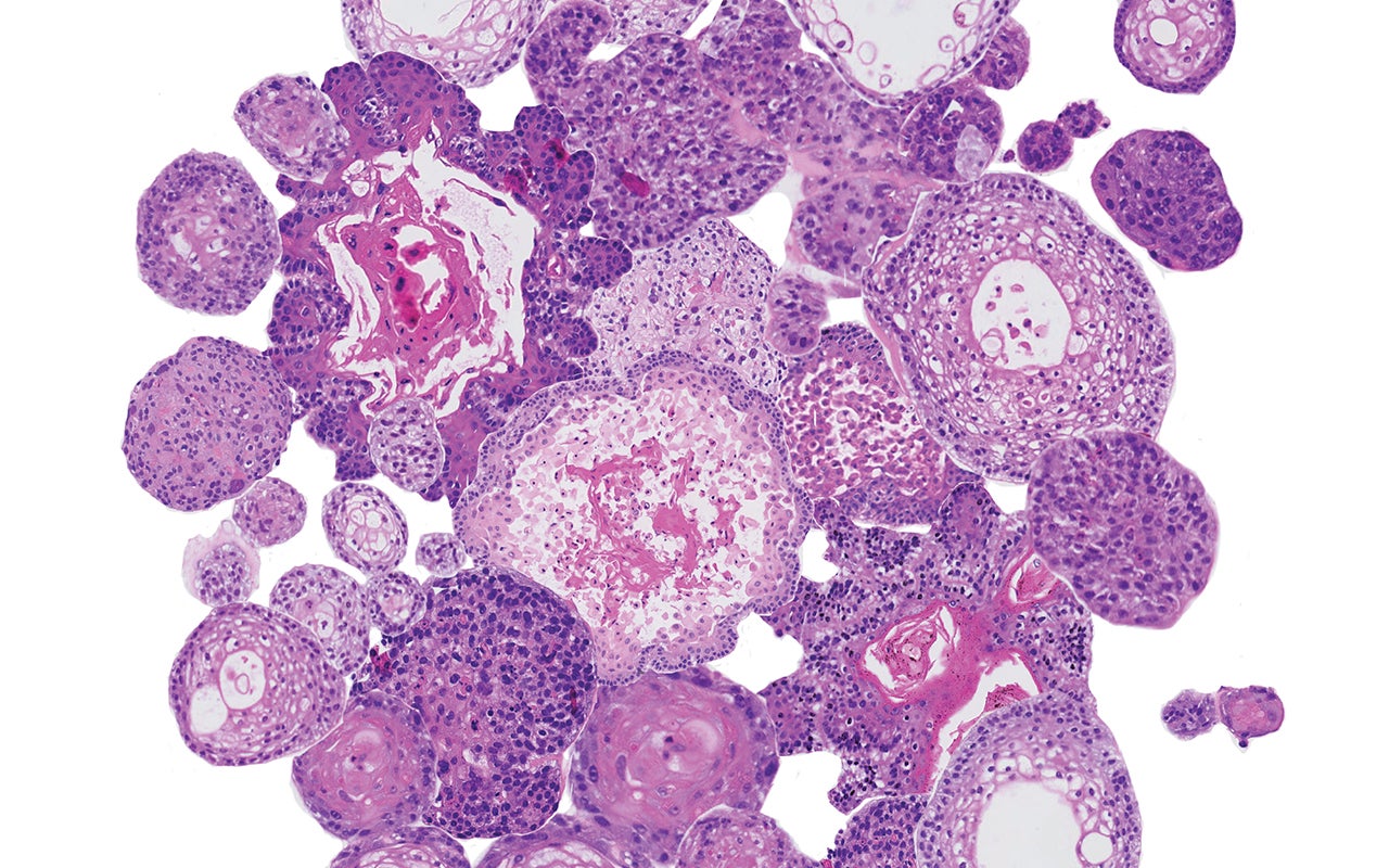 Een microscoopopname van een groep cellen