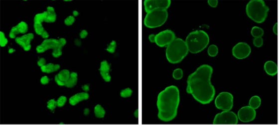 Links: CF-organoïden. Rechts: Gezonde organoïden