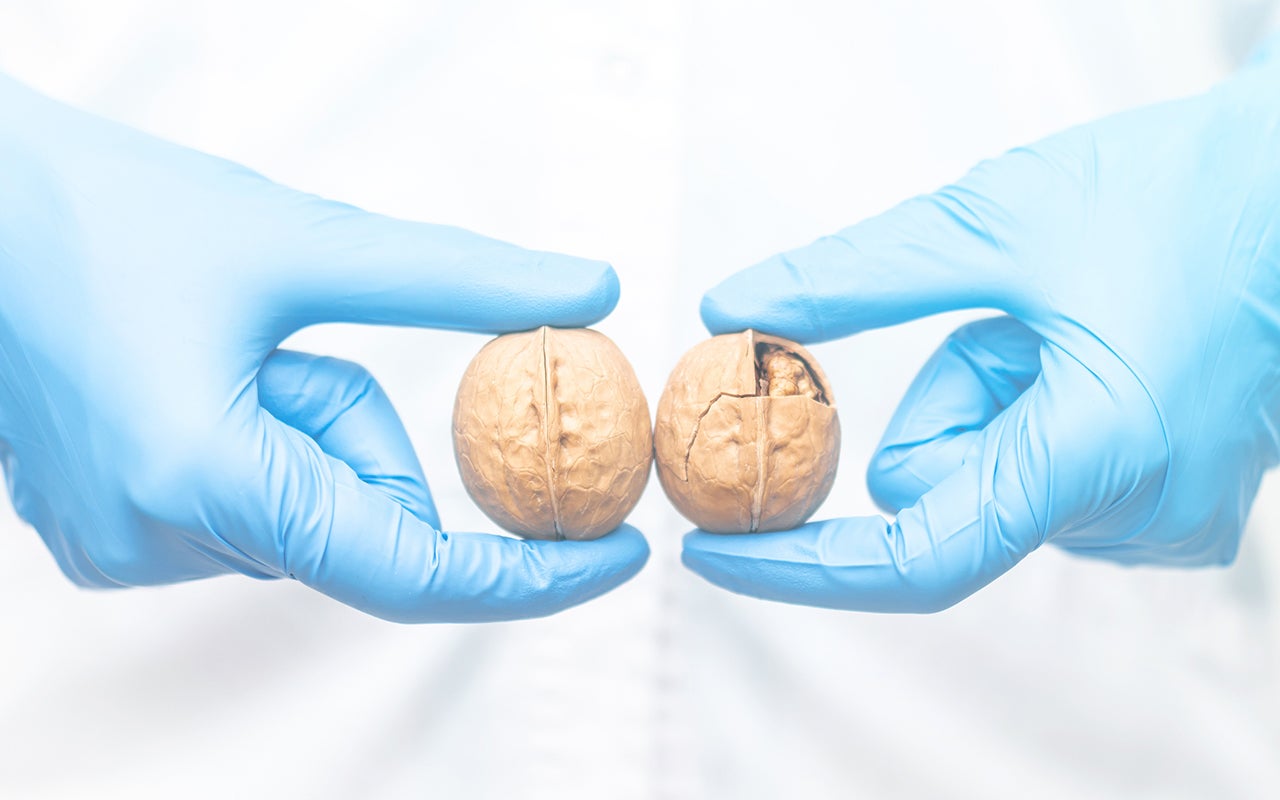 Een paar handen die walnoten vasthouden.