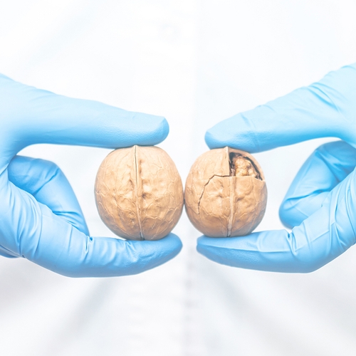 Een paar handen die walnoten vasthouden.