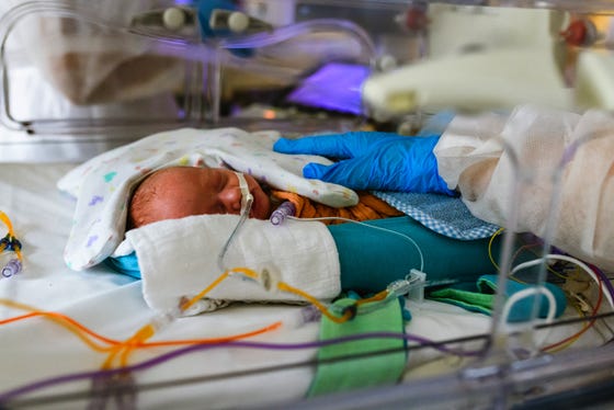 Te vroeg geboren baby met een hand van een zorgverlener op het lijfje