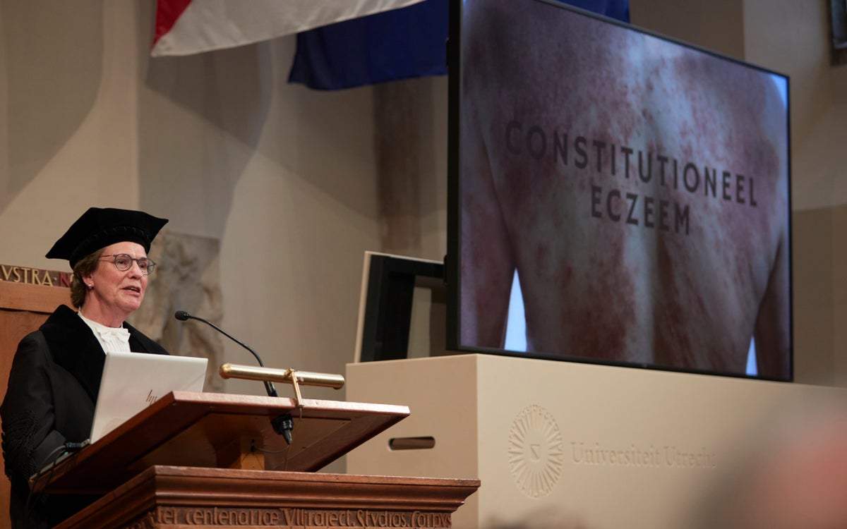 Prof. Marjolein de Bruin-Weller houdt haar oratie over constitutioneel eczeem, met op het beeldscherm een afbeelding van een persoon met eczeem.